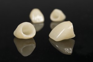 Fundas dentales de Porcelana